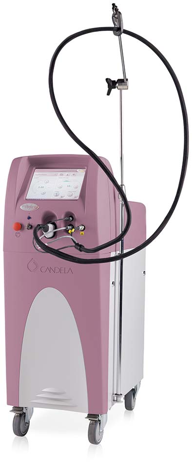 Laser vascular PDL